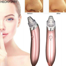 Blackhead Vacuum Electric Pore Cleaner